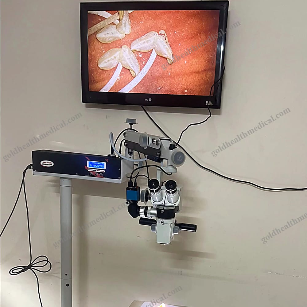 ROSLANE MEDITECH Microvascular Neuro Surgery Microscope