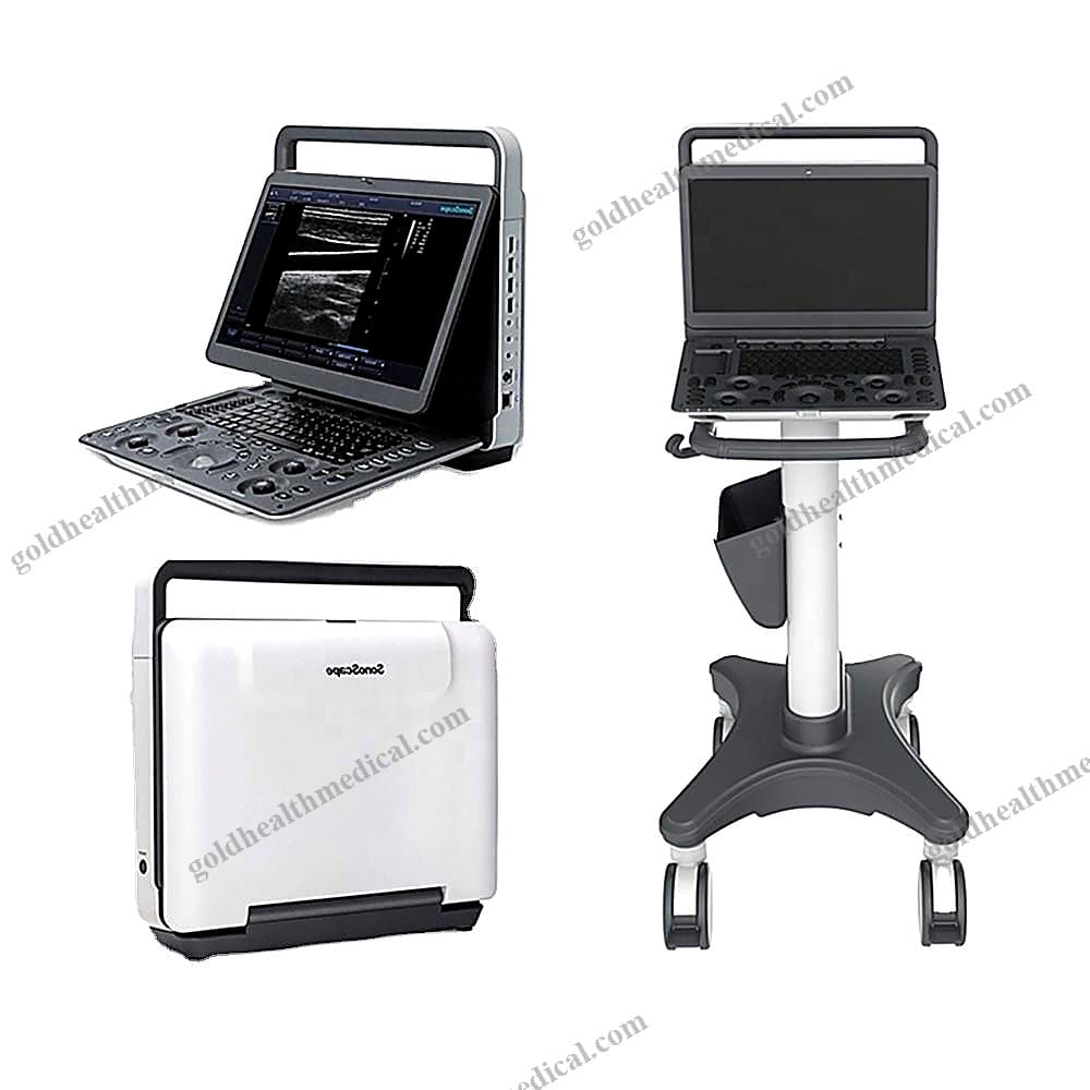 Sonoscape E2 Portable Ultrasound Scanner