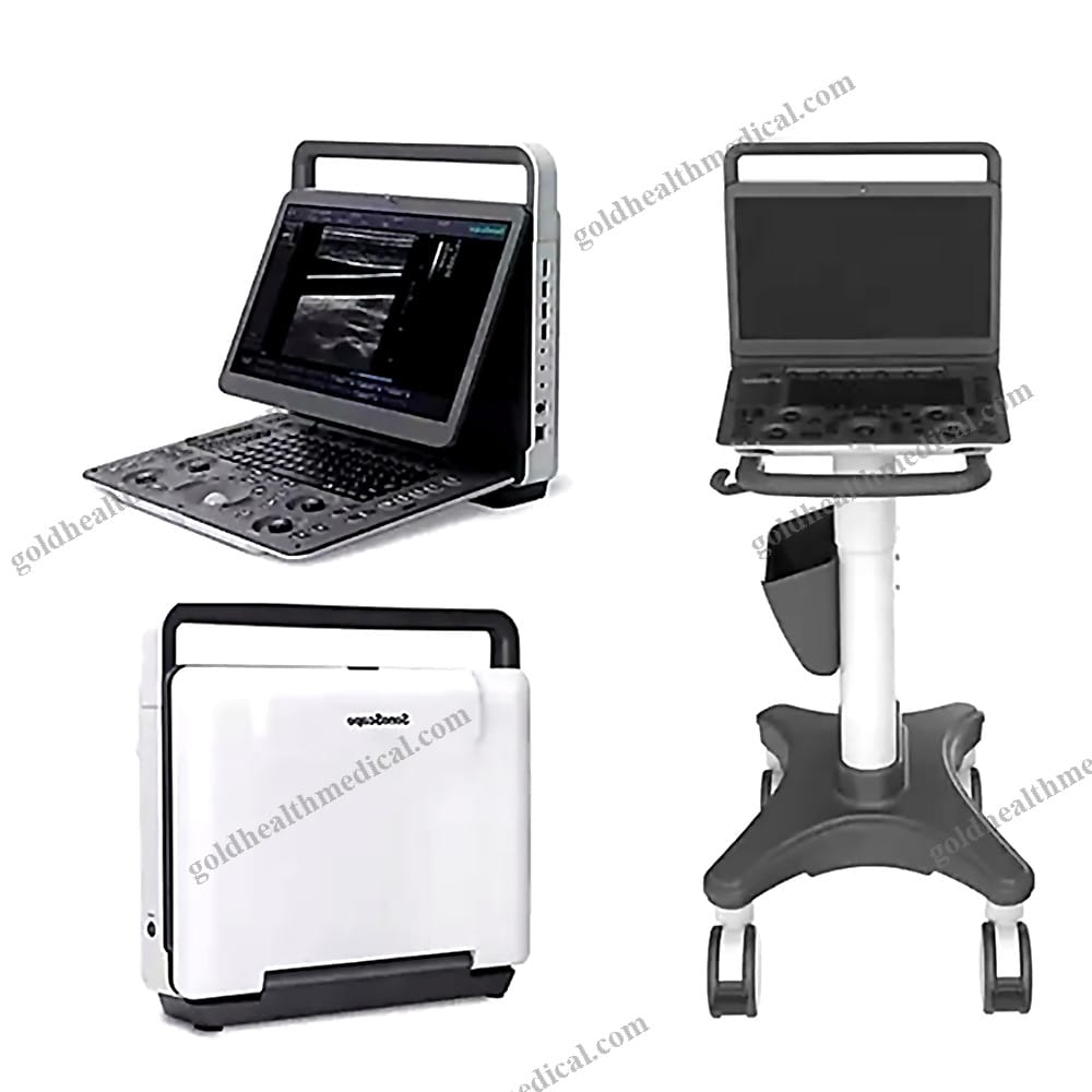 10000013820365_1 Sonoscape ESeries Portable Ultrasound Machine with Trolley - Image 1