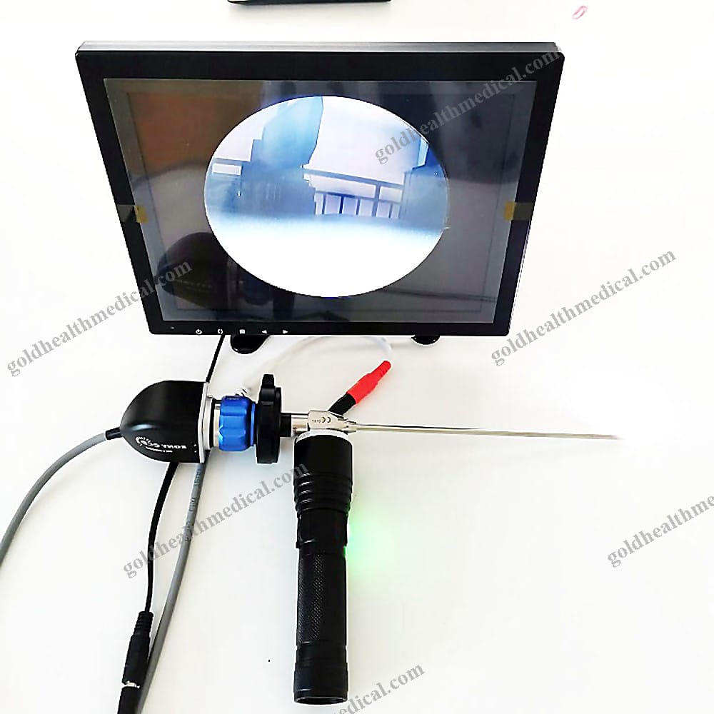 1600108501243_1 Portable ENT Endoscope Camera Pro - Image 1