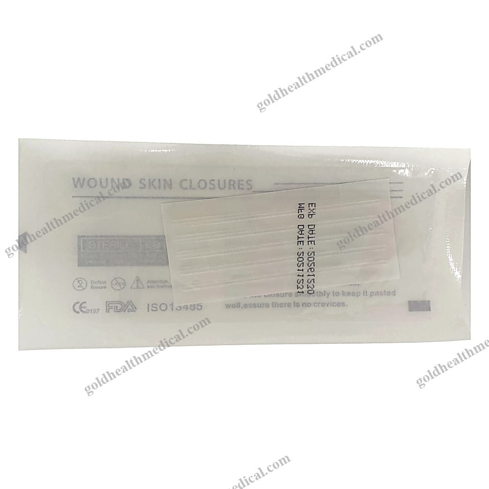 ZipSkin NonInvasive Wound Closure Device