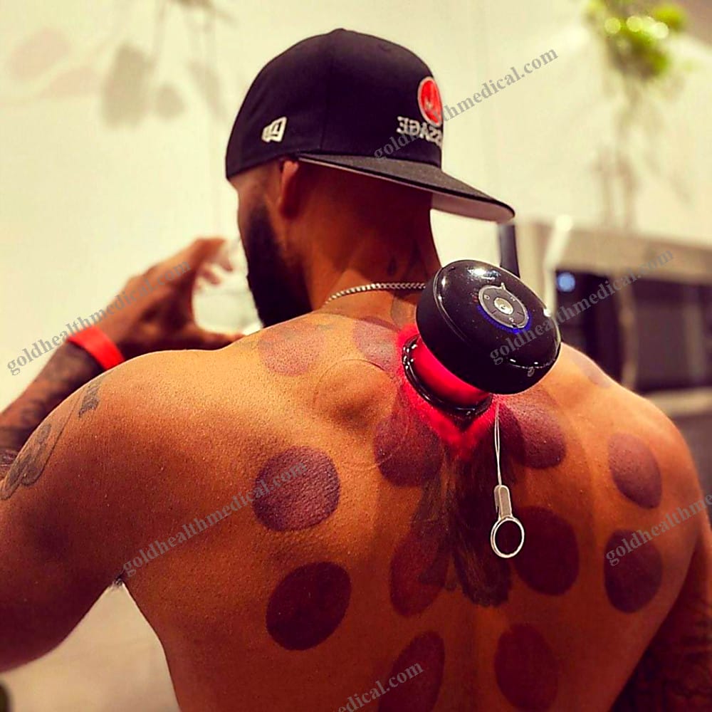 Achedaway Smart Massage Cupping Sets Electric Vacuum Cupping Device