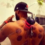 Achedaway Smart Massage Cupping Sets  Electric Vacuum Cupping Device
