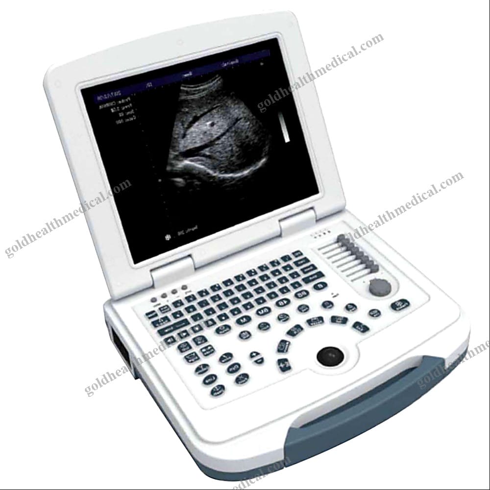 Longermay Full Digital Portable Ultrasound Scanner