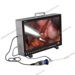 SYPS050 HD 1080 Endoscope for