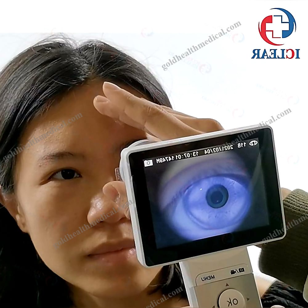 2M Pixels HD Ophthalmic Retina Camera Handheld LCD Eye Fund