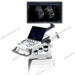 Digital Doppler Color Ultrasound Scanner for Hospital Obstetrics Use