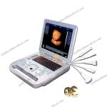 SUN800D Portable 3D Gynecologic Ul