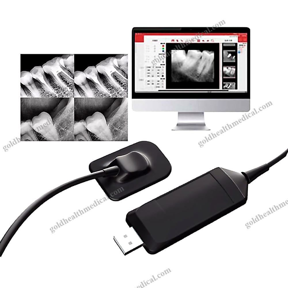 Intraoral Digital XRay Sensor for Dental Clinics