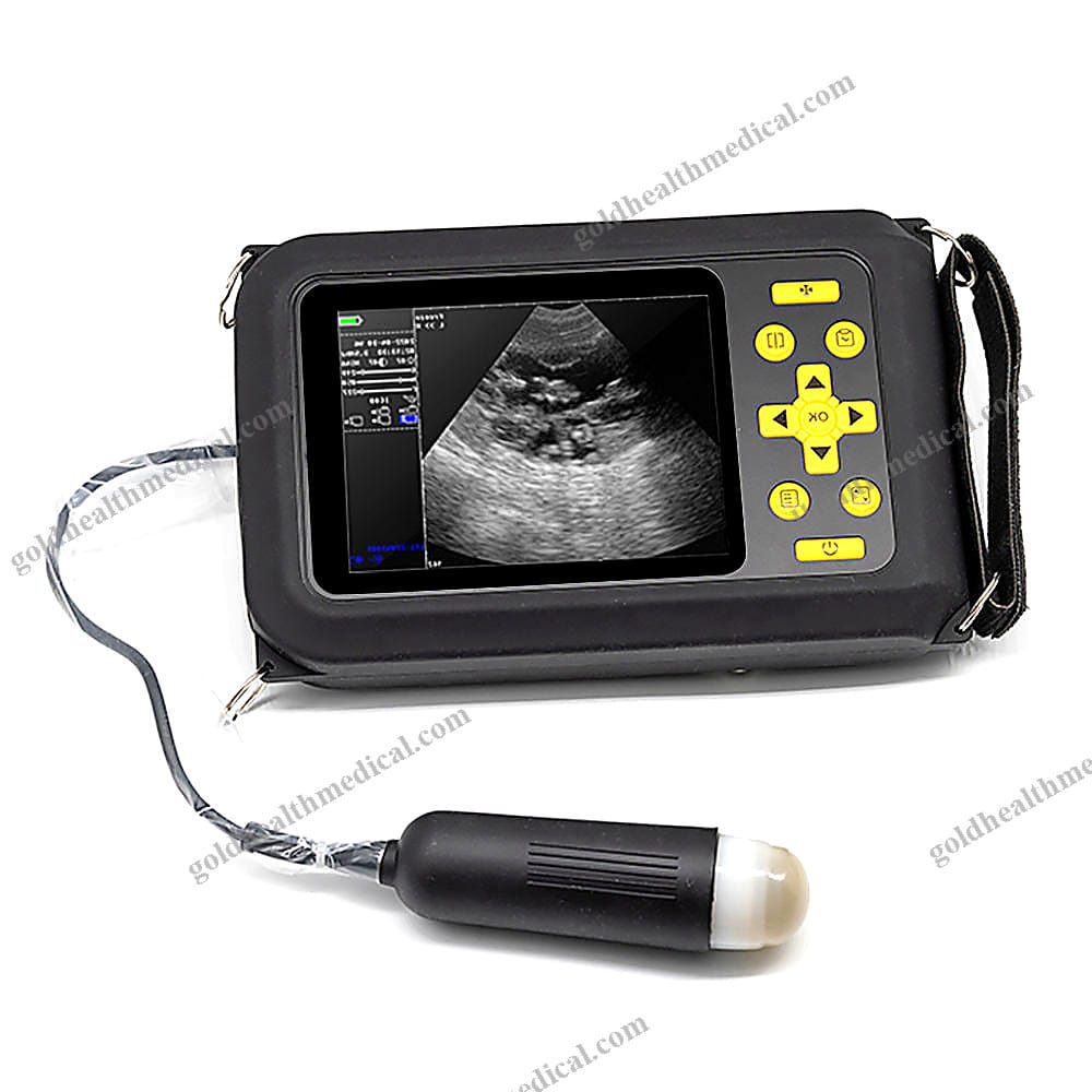 Portable 56 Digital Veterinary Ultrasound Machine
