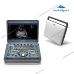 Sonoscape X3 Portable Ultrasound Machine