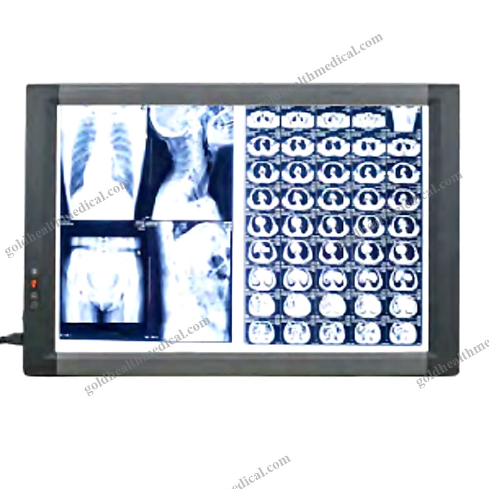 Medical XRay Film Viewer Negatoscope Display Panel for Hospital Dental Use