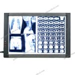 Medical XRay Film Viewer Negatoscope Display Panel for Hospital  Dental Use