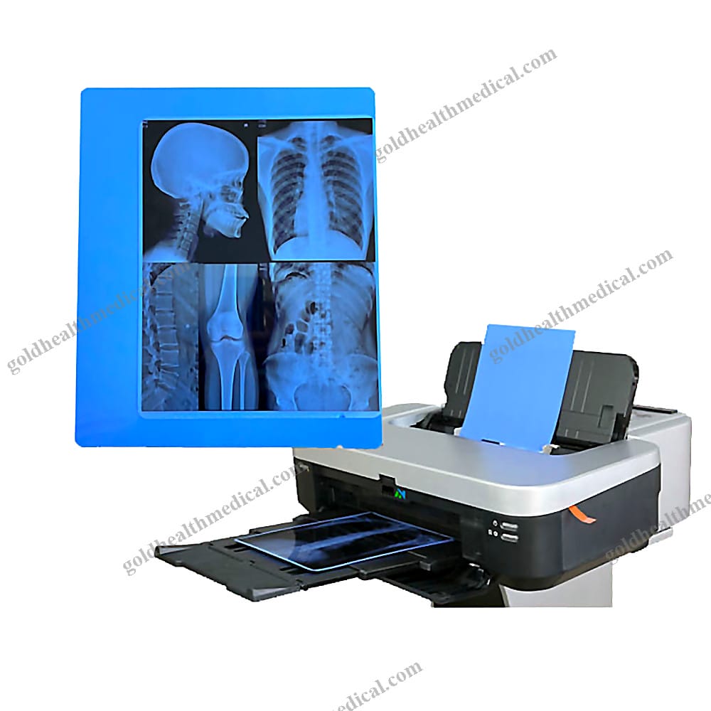 A4 Inkjet XRay Blue Film for Canon Epson Printers