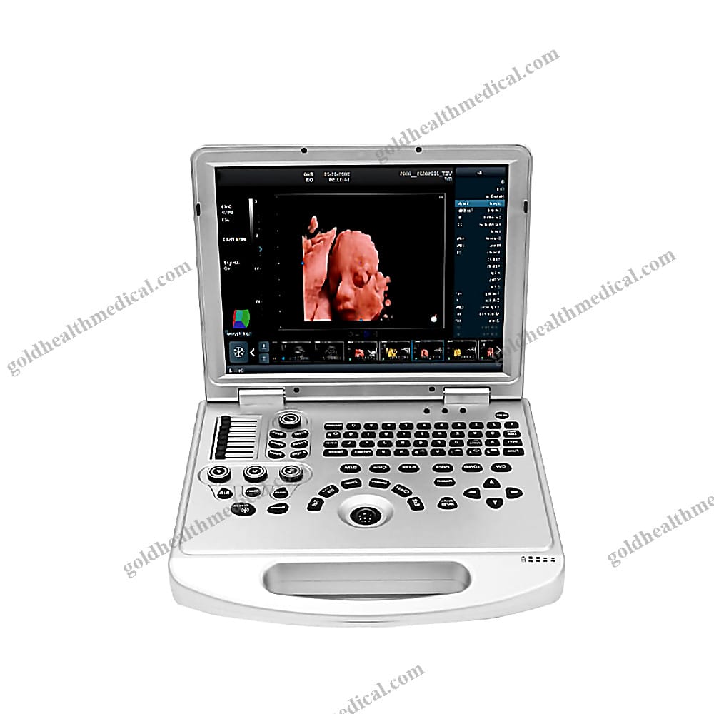 Dawei Advanced 3D4D5D Color Doppler