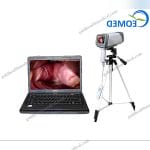 Digital Video Colposcope DVC5002