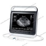 Portable Ultrasound Machine with Cardiac Probe for Hospitals and Clinics