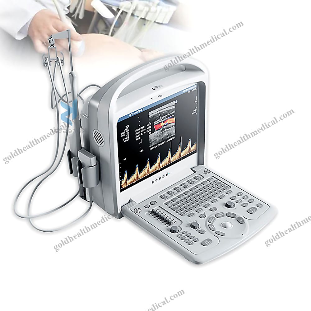 Handheld Color Doppler Ultrasound System