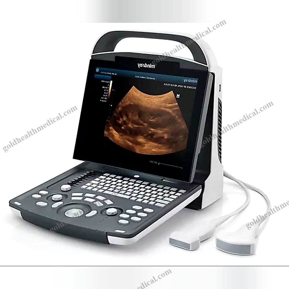 Mindray DP10 Portable Digital Ultrasound Scanner BW
