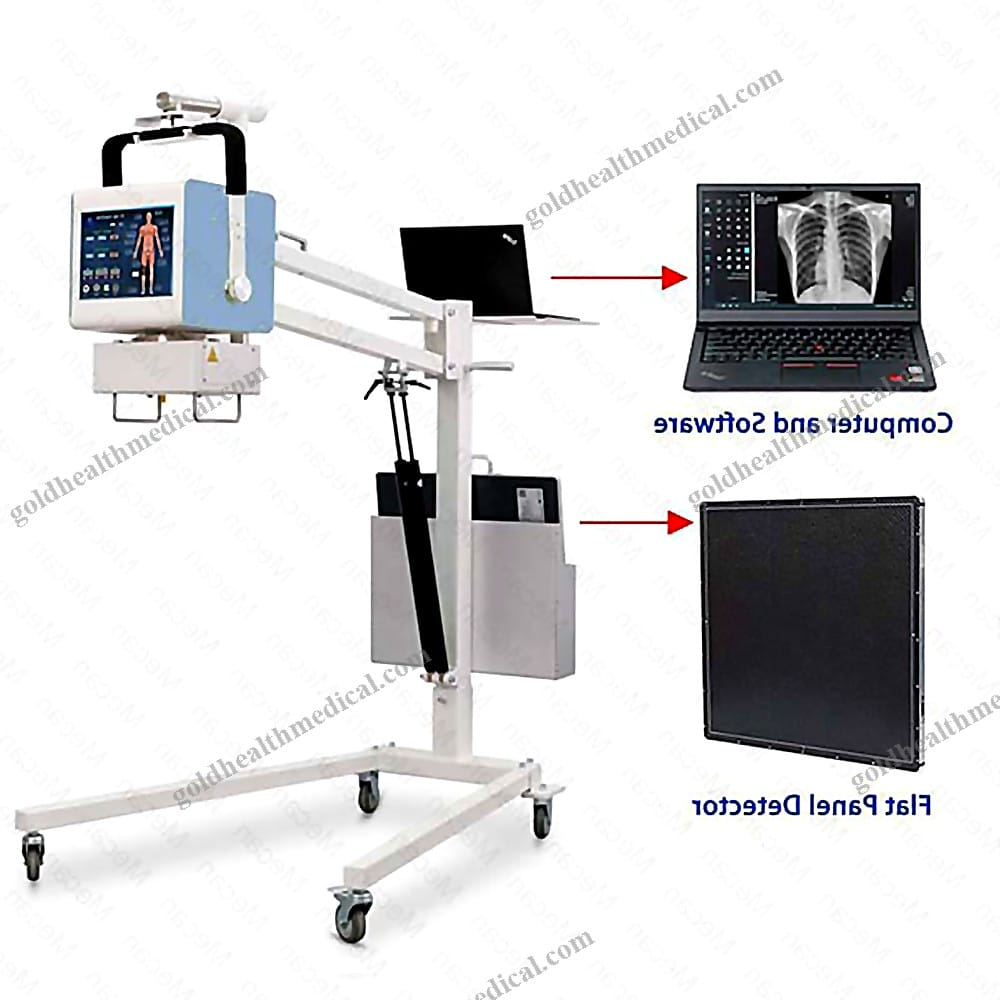 5Kw High Frequency DR Flat Panel Detector XRay System Mobile Digital Radi