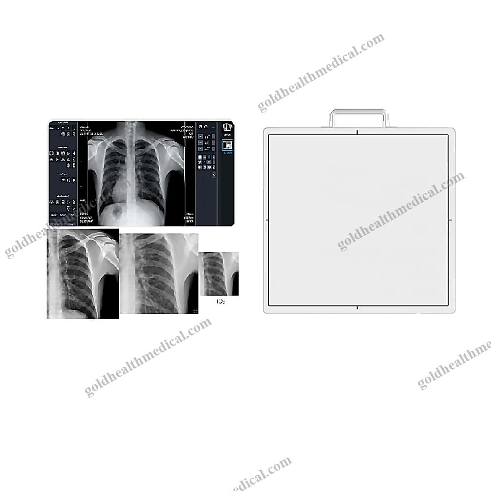 14x17 CsI FPD Wireless Detector for HumanV