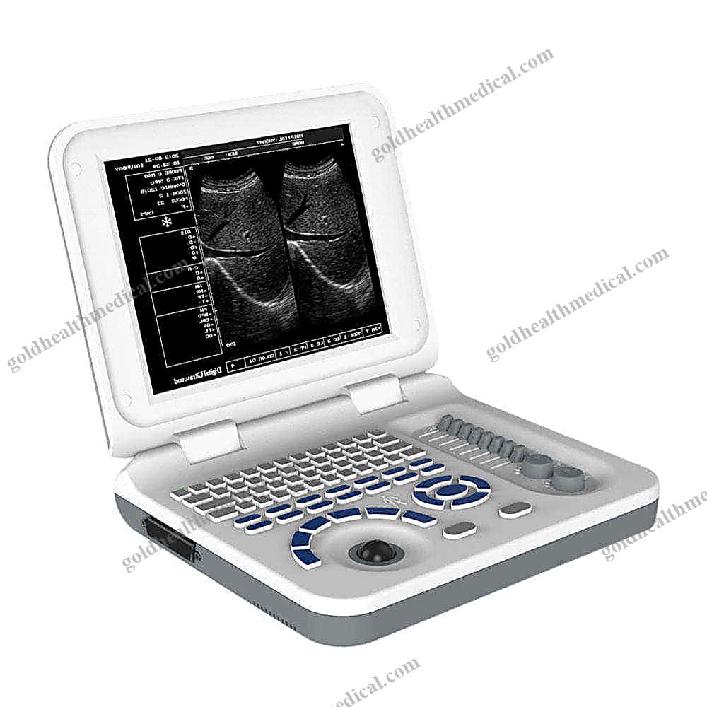 Longermay Full Digital BW Laptop Ultrasound Machine
