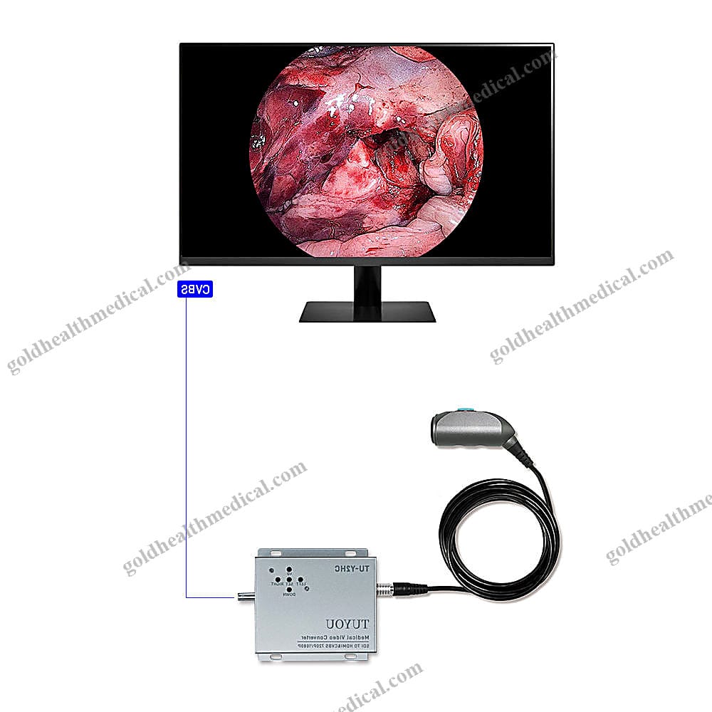 Tuyou 1080P HD Portable ENT Scope with Camera
