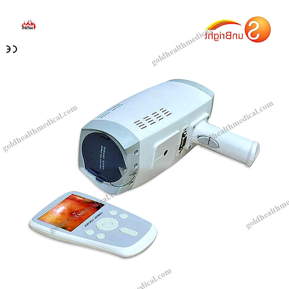 Handheld Digital Colposcope for Gynecology