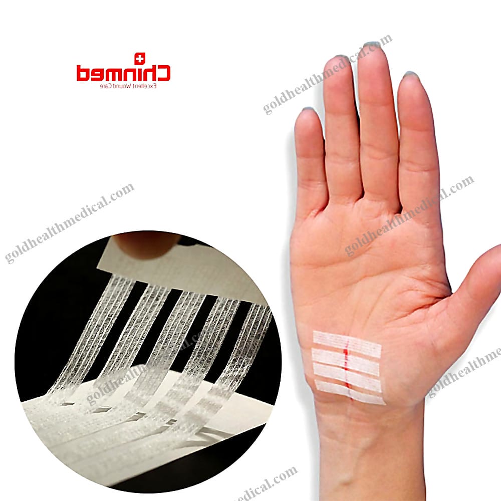 SteriStrip Skin Closure Solution