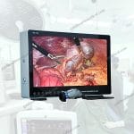 SYPS050 Full HD Endoscopy Camera for Uro