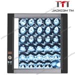 MT MEDICAL LED XRay Film Viewer Single Side