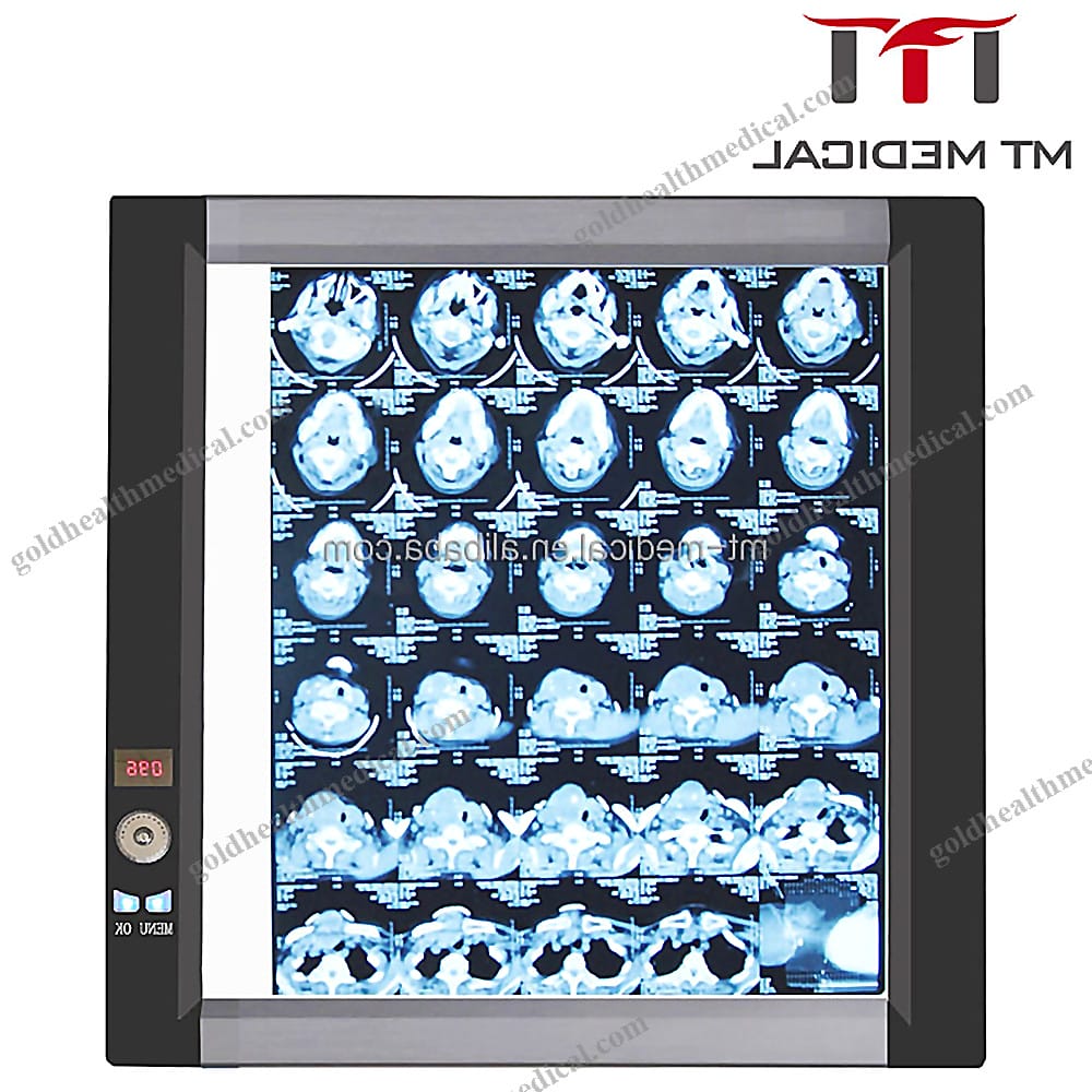 1600813128739_1 MT MEDICAL LED XRay Film Viewer Single Side - Image 1