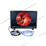 Full HD 1080p Urology Endoscope Camera System