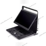 SonoScape E1 Exp Compact Color Doppler Ultrasound Machine with