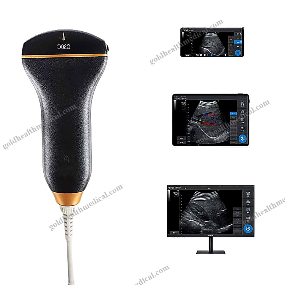 Portable Linear Doppler Ultrasound Device for Clinics