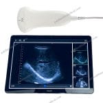 Portable Digital Ultrasound System with Handheld Probe