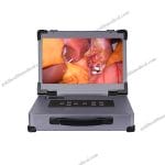 Portable Endoscopy Camera for ENTLaparoscopyHysteros