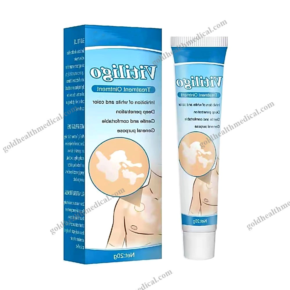 Vitiligo Treatment Cream with Herbal Extract for Ringworm White Spot