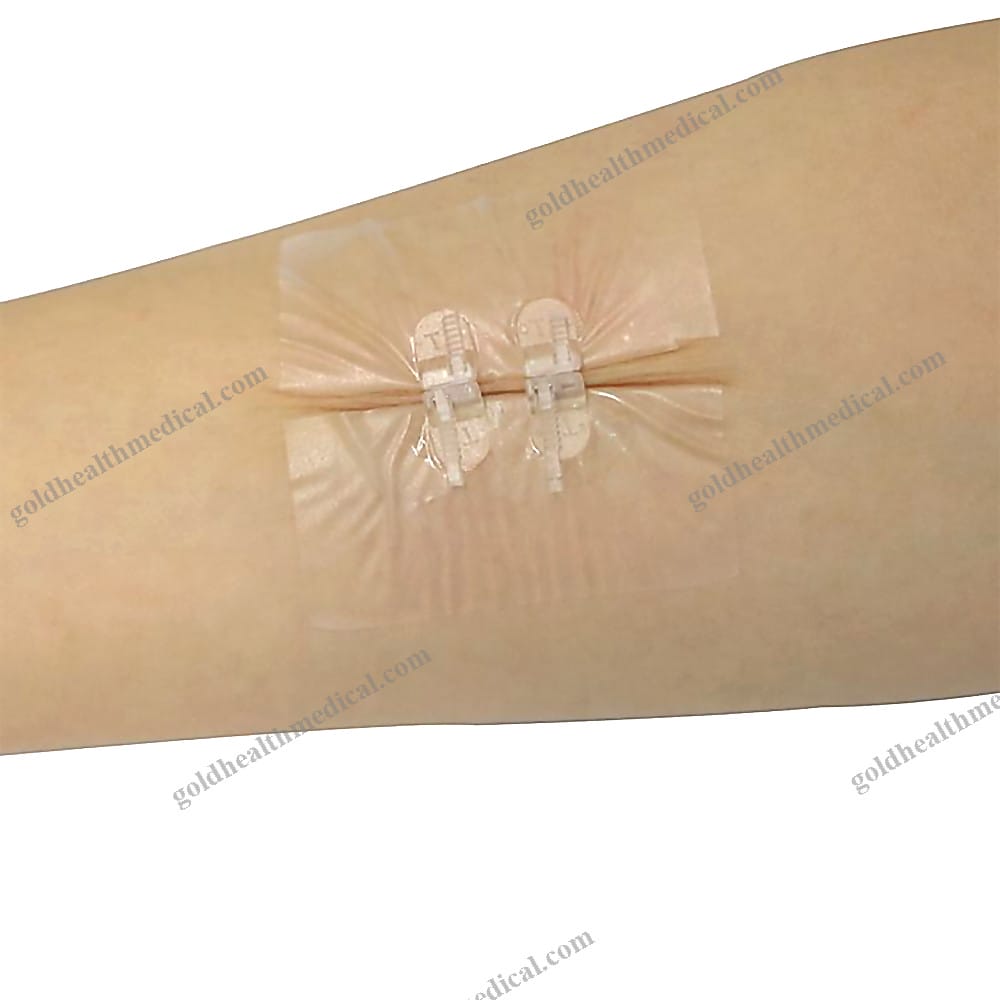 Medical Grade Wound Closure Strip Suture and StapleFree Skin Closure Device