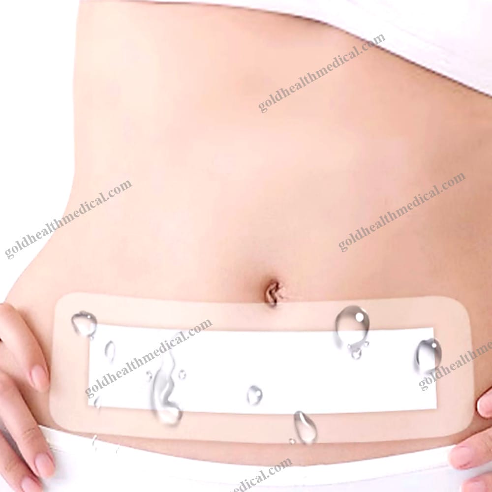 NonWoven Medical Adhesive Wound Dressing Band Aid Bandage