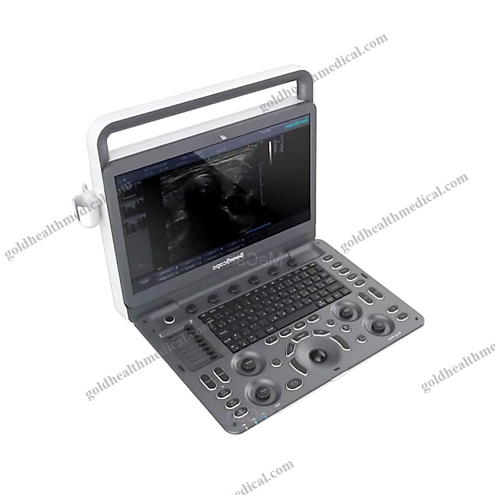 Sonoscape E2 Portable Color Doppler Ultrasound Machine