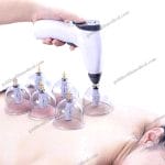 Smart Electric Cupping Massager Set