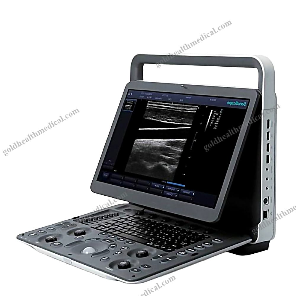 Sonoscape E2 Doppler Ultrasound Machine