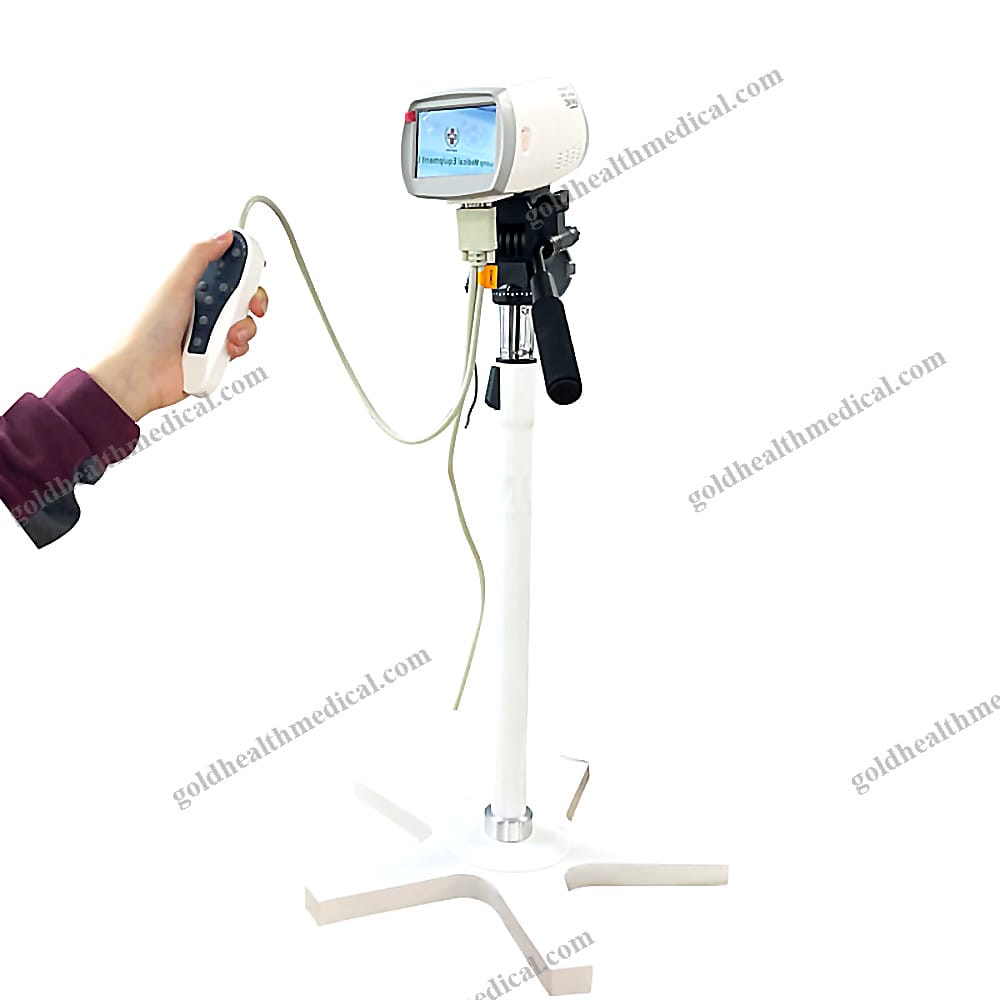 SYF005HD1 HD Digital Video Colposcope for