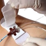 PICCCVC Catheter Securement Dressing Sticker