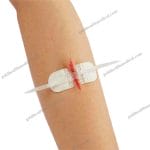 SteriStrip Skin Closure Tape for Medical Surgical Use