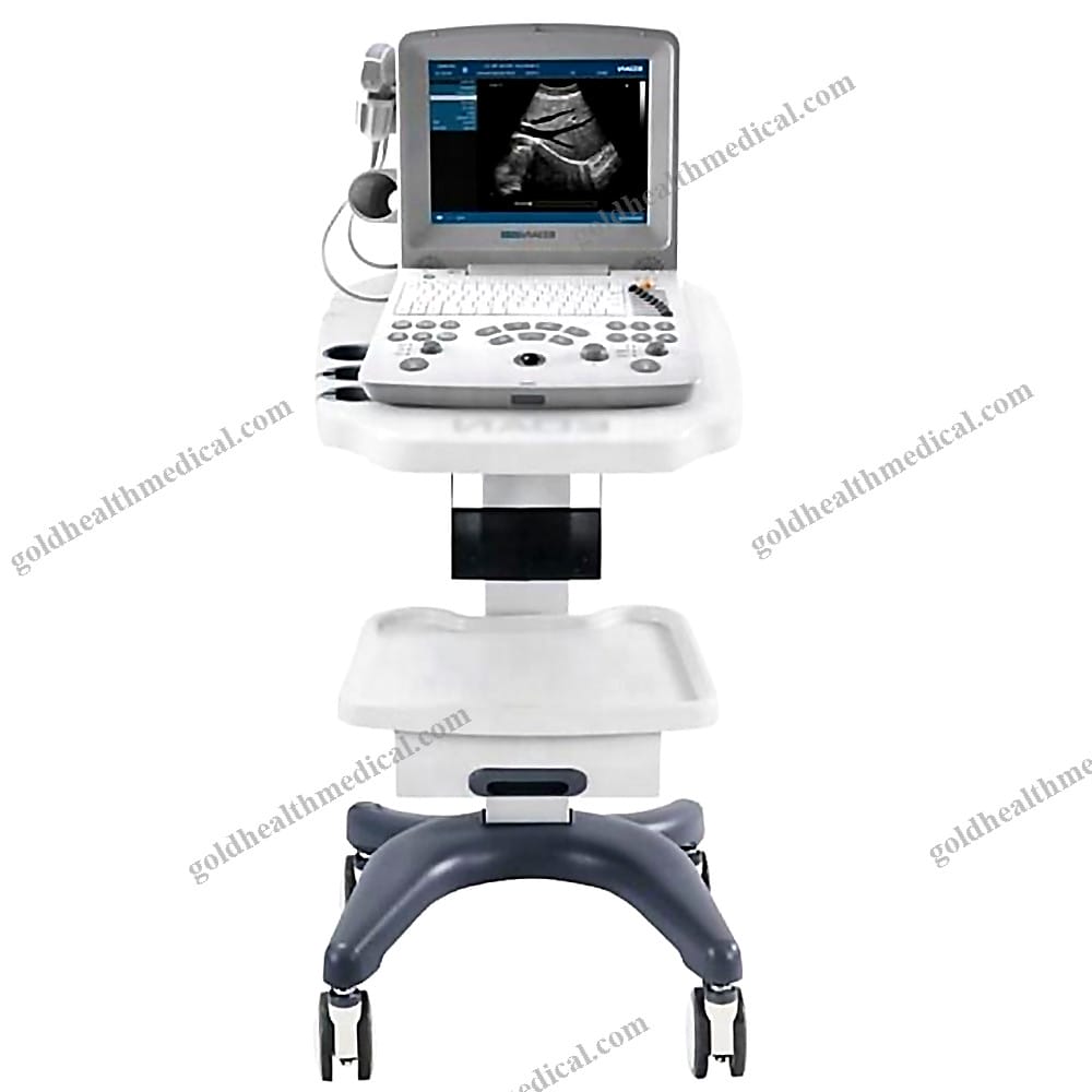 Edan DUS60 Portable Ultrasound Machine Black White Medical Imaging