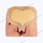 Sacrum Bedsore Silicone Foam Dressing