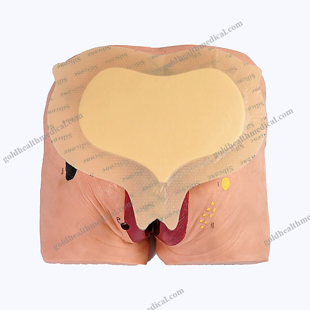 1601020471202_1 Sacrum Bedsore Silicone Foam Dressing - Image 1