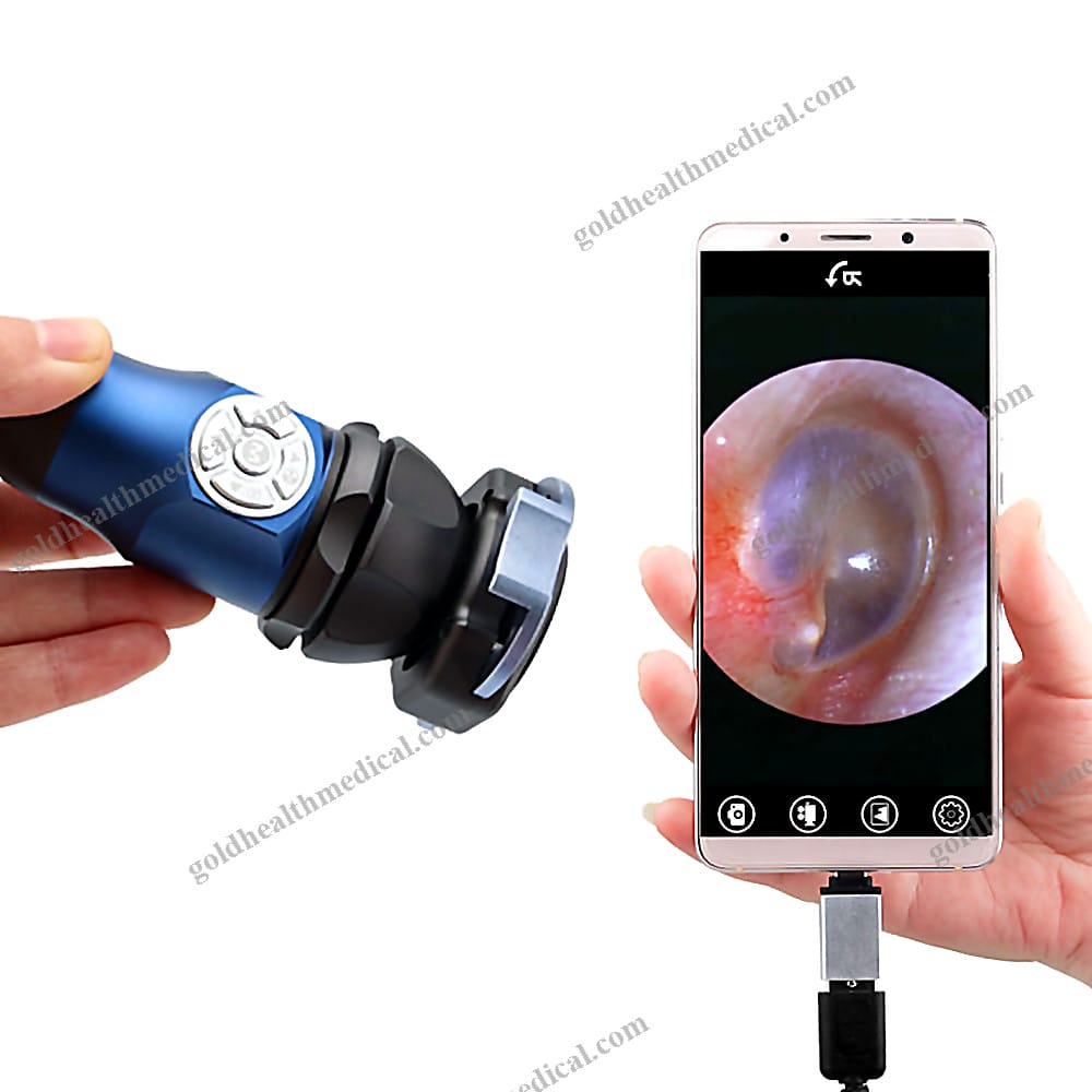 ENT Endoscopy Camera System Portable HDMI HD 1080P
